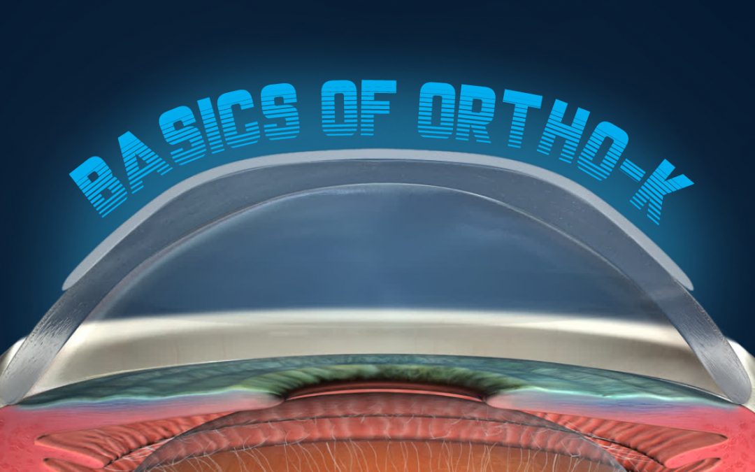 Basics of Ortho-K